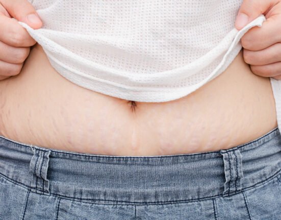Woman testing her skin showing no.