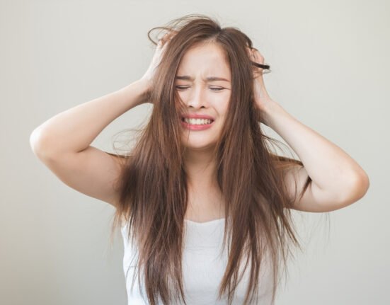 Asian woman hair having problem dandruff.