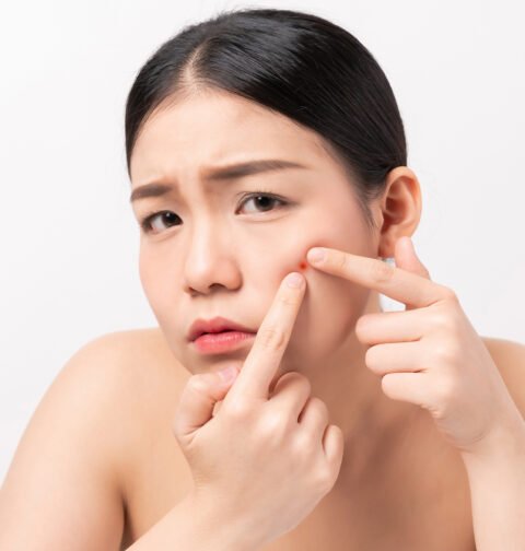Asian woman squeezing pimples on her