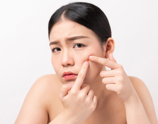 Asian woman squeezing pimples on her