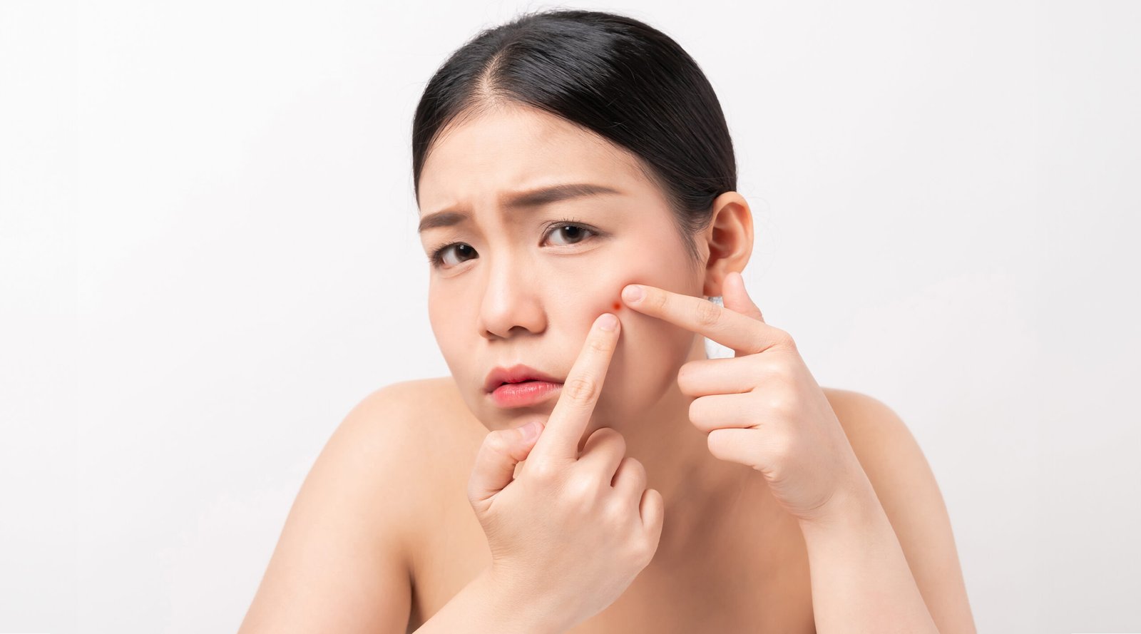 Asian woman squeezing pimples on her