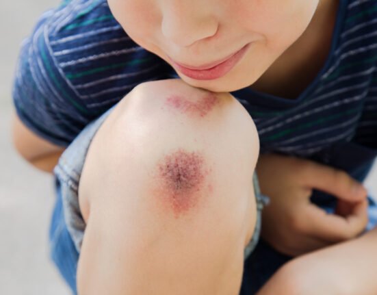 Closeup injured young kids knee after