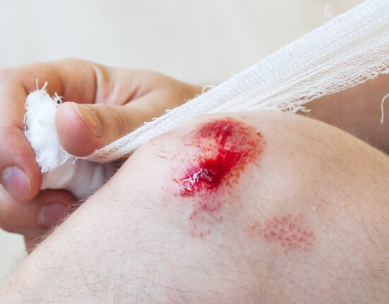 Man heals wound on the knee.