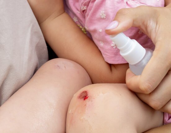 Treating child scrape knee infection.