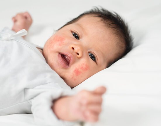 New born baby skin rashes on