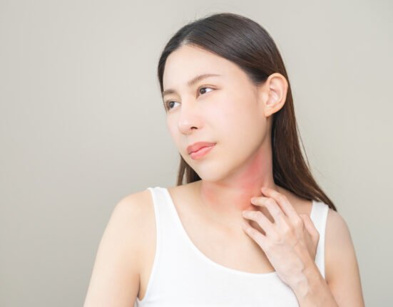 Dermatology concept Asian young woman girl