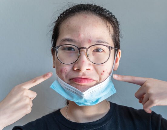 Young Asian woman open her mask